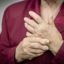 Hands Of Woman Deformed From Rheumatoid Arthritis. Pain
